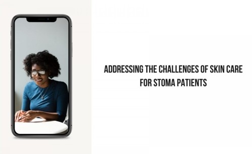 Addressing the Challenges of Skin Care for Stoma Patients