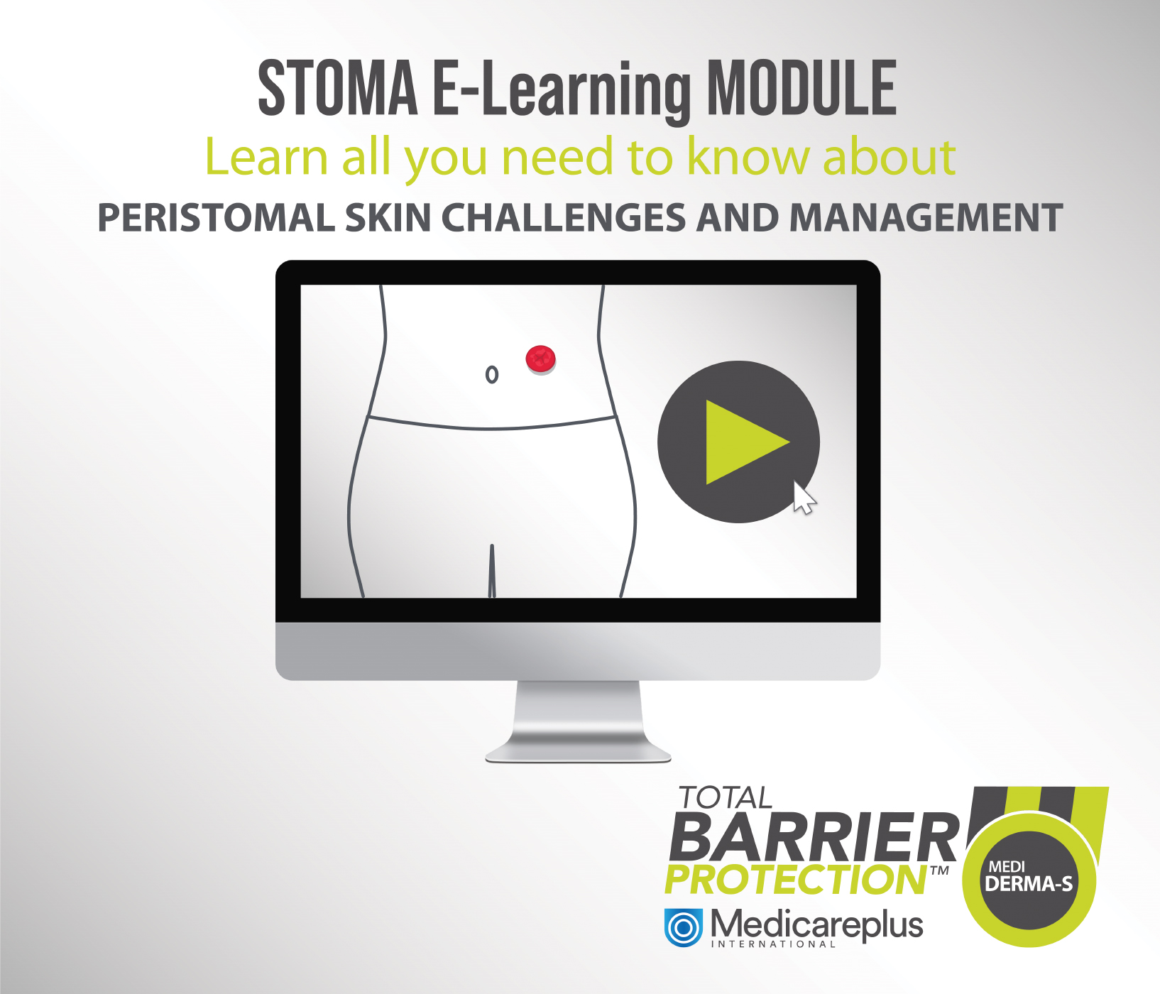 PERISTOMAL SKIN: CHALLENGES AND MANAGEMENT