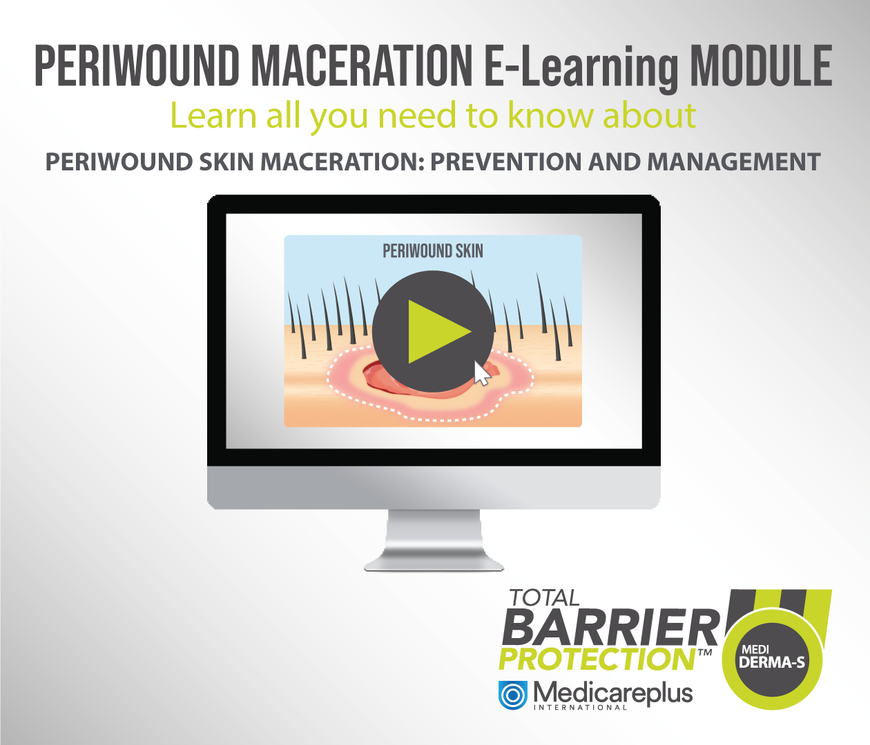 Periwound skin maceration: prevention and management
