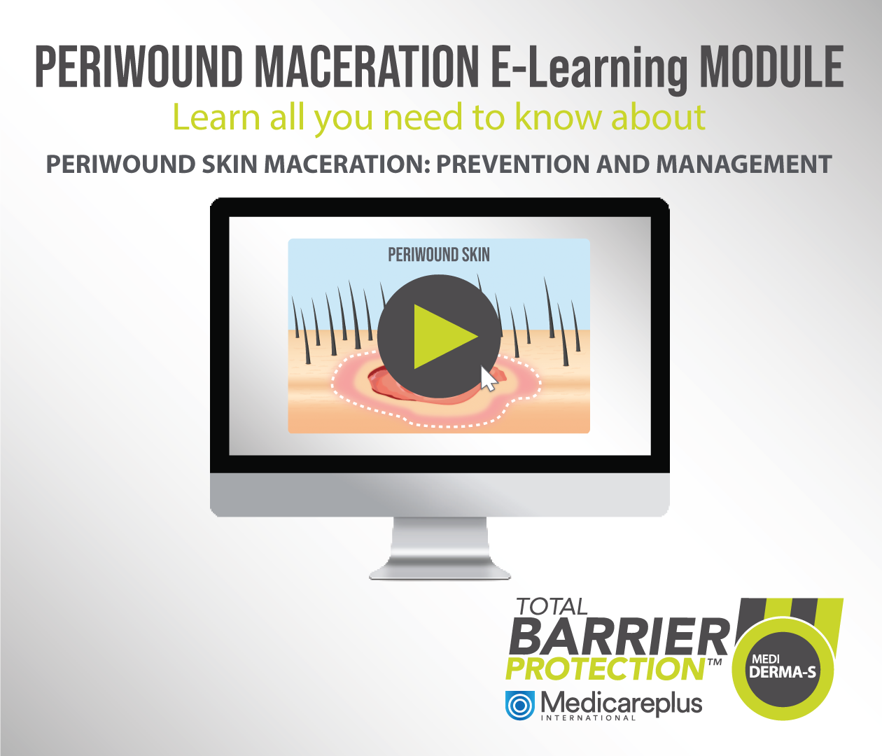 PERIWOUND SKIN MACERATION: PREVENTION AND MANAGEMENT