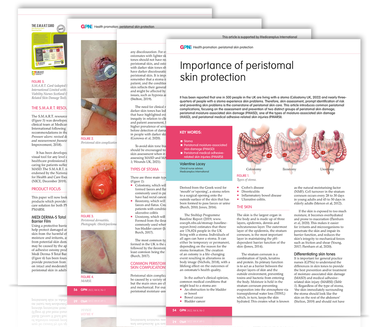 Importance of peristomal skin protection