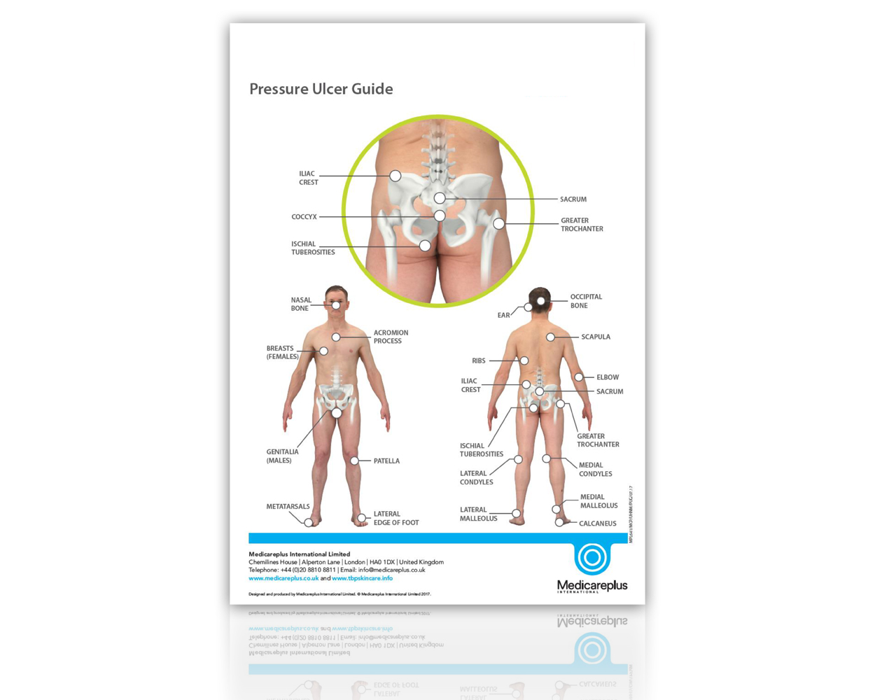 Pressure Ulcer Guide